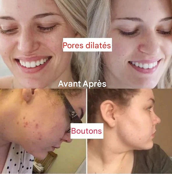 Diystar™ Masque Nettoyant en Profondeur au Thé Vert 100% Naturel