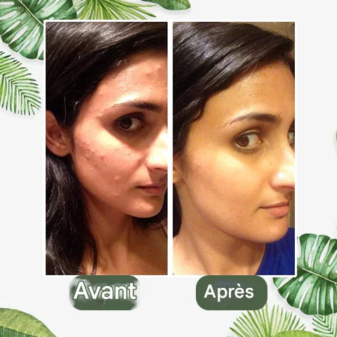 Diystar™ Masque Nettoyant en Profondeur au Thé Vert 100% Naturel