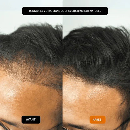 GROWY™ Poudre capillaire - Achetez-en 1 et recevez-en 2