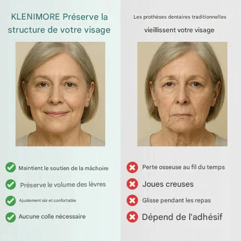KLENIMORE™ Prothèse Dentaire Complète Médicale avec Forte Succion